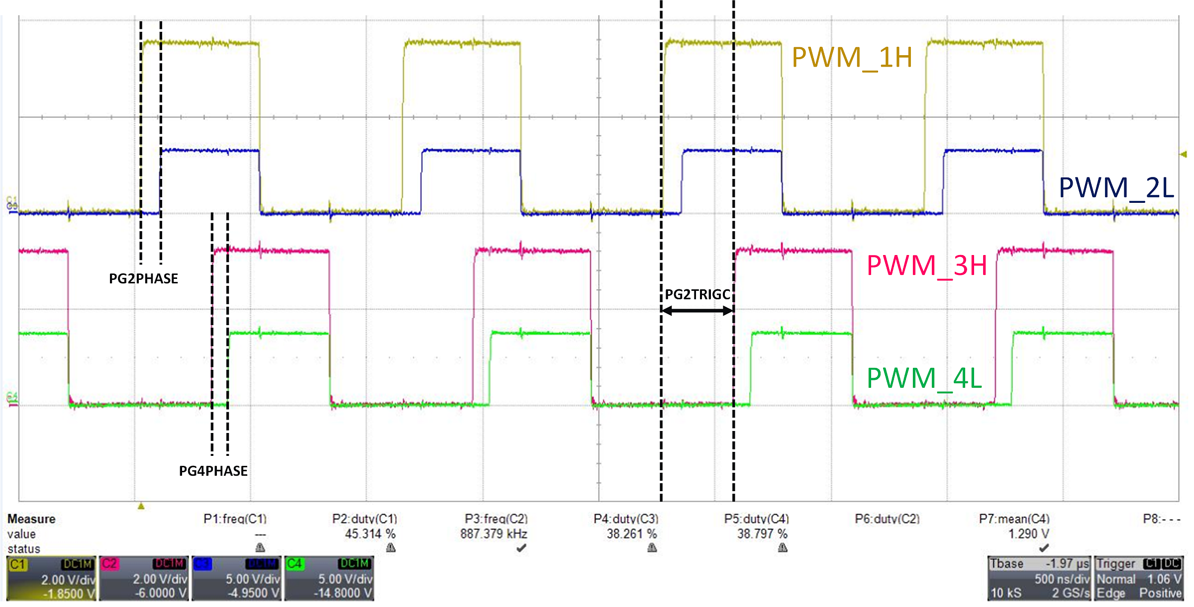 PWM2 setup